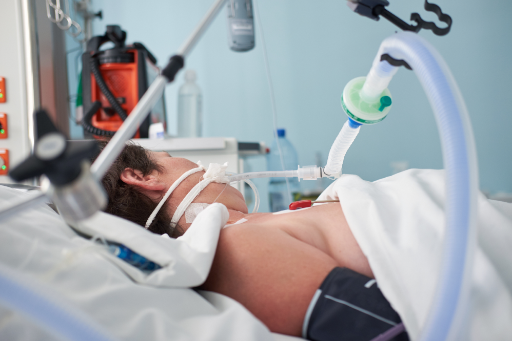 An unconscious patient on a ventilator in a hospital ICU