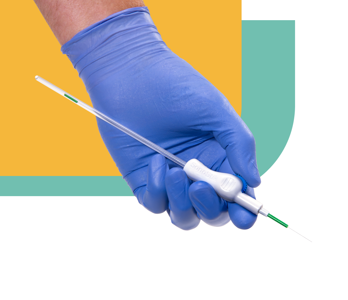 A clinician’s gloved hand holding the SonoStik IV Guidewire Introducer, a venous access device